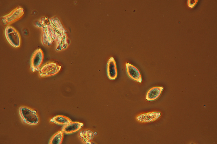 Forse nemmeno una crosta - foto 3364 (Haplotrichum aureum)